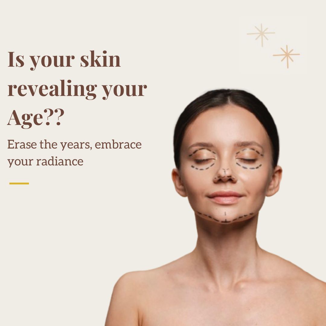 Aging